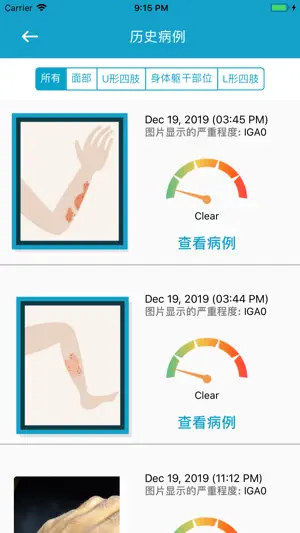 EczemaLess, 湿疹指南